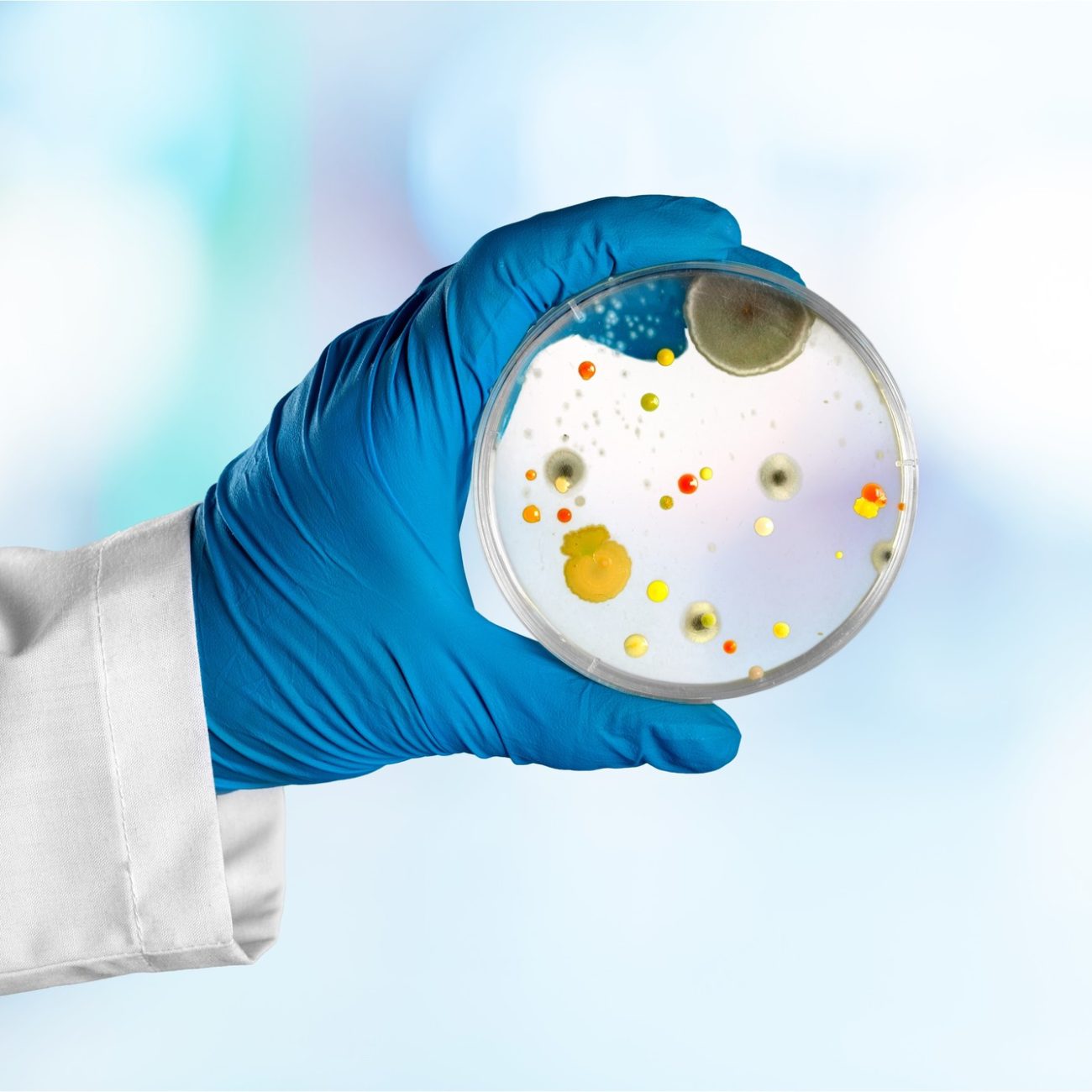 Why Professional Mold Testing Matters